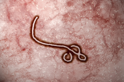 Ebola Virus Electron Micrograph (EM)