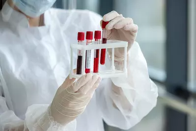 nurse with test tubes